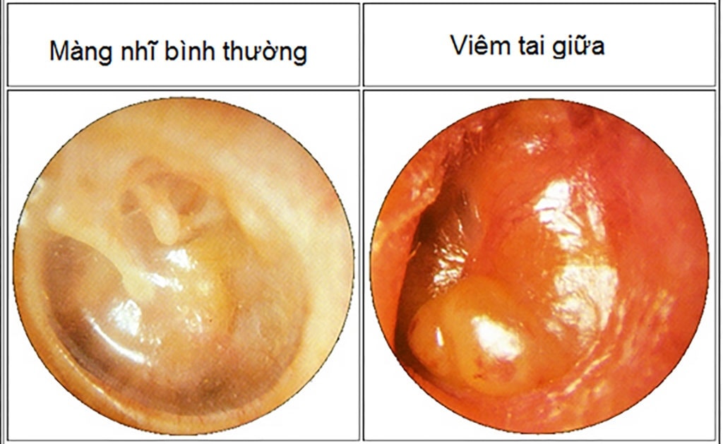 TAI MŨI HỌNG ĐỒNG NAI