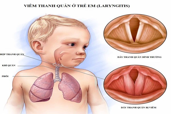 TAI MŨI HỌNG ĐỒNG NAI